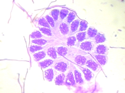 Cliquer sur l'image pour l'agrandir