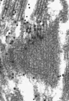 Marquage par des&nbsp;anticorps anti PSI. 