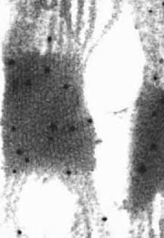 Marquage par des&nbsp;anticorps anti PSII