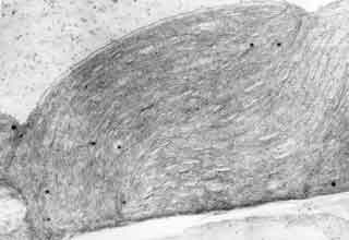 Vue g&eacute;n&eacute;rale d'une portion de cellule de la gaine p&eacute;rivasculaire. 