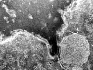 ATP-synthases sur les bords d'un thylaco&iuml;de