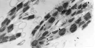 Chloroplastes "cass&eacute;s"