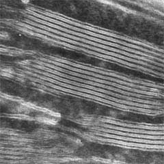 Coupe &agrave; cong&eacute;lation color&eacute;e n&eacute;gativement