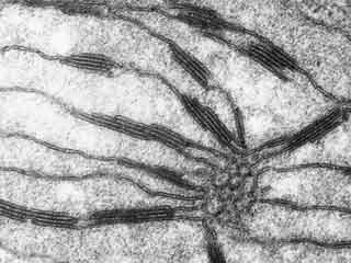 Détail. Désorganisation du corps prolamellaire