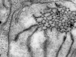 Détail. Autre vue d'un corps prolamellaire.