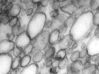 S&eacute;paration des thylaco&iuml;des intergranaires