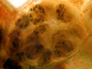 Cellule de la gaine p&eacute;rivasculaire  color&eacute;e par le lugol