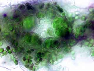 D&eacute;tail de la r&eacute;gion p&eacute;rivasculaire