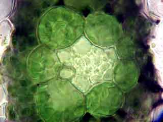 D&eacute;tail de la r&eacute;gion p&eacute;rivasculaire. Fort grossissement