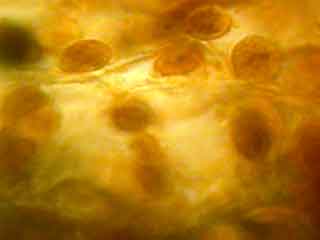 Cellule du m&eacute;sophylle color&eacute;e par le lugol.