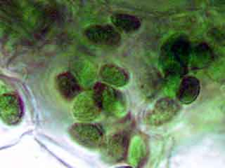 Cellule du m&eacute;sophylle.