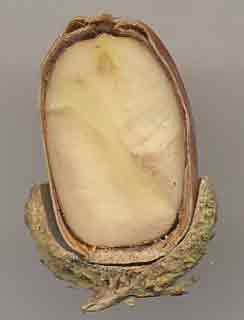 Coupe longitudinale de gland