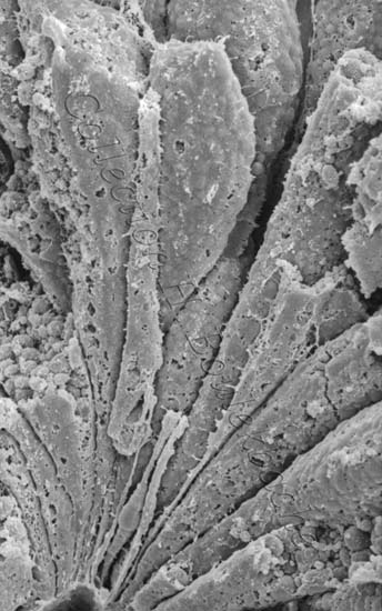 Cellules en bouteille06