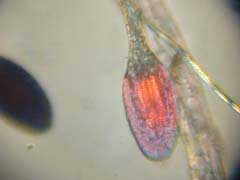 Vue g&eacute;n&eacute;rale d'un poil de Drosera aliciae. 