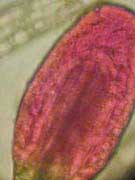 Drosera aliciae : d&eacute;tail