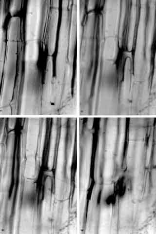 Séries de sections optiques réalisées dans une coupe longitudinale de parenchyme cortical d'hypocotyle de soja