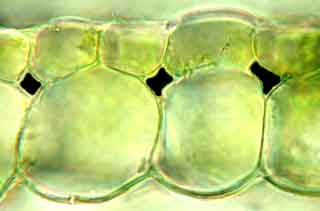 lacunes a&eacute;rif&egrave;res de feuilles d'&eacute;lod&eacute;e color&eacute;es artificiellement en noir