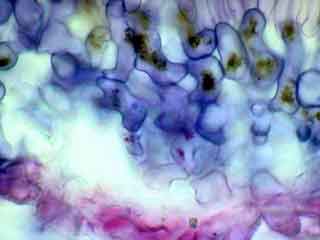 Parenchyme lacuneux de feuille d'&eacute;rable