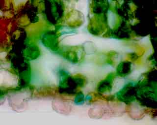 Parenchyme lacuneux