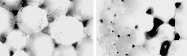 Hypocotyle de soja Détail de sections transversales
