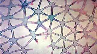 D&eacute;tail de l'a&eacute;renchyme de la tige de jonc