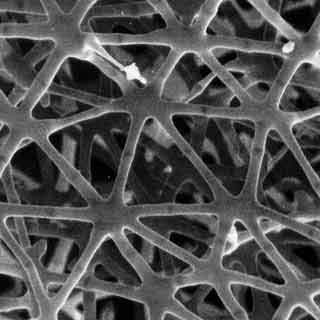 MEB A&eacute;renchyme de la tige de jonc