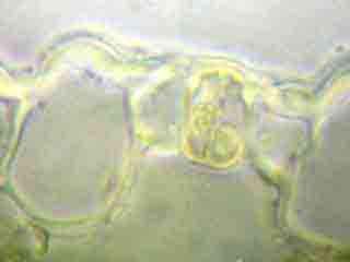 Stomate de feuille de s&eacute;taire vue en section