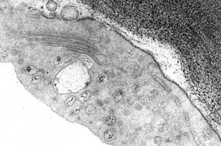 polysaccharides contrast&eacute;s  par un test cytochimique (PATAg)