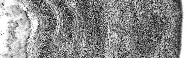 Paroi épidermique d'hypocotyle de soja en croissance