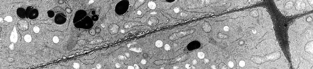 jeune paroi observée en microscopie électronique à transmission (MET)