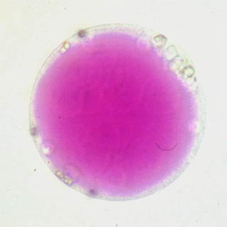 protoplaste isolé de chou rouge